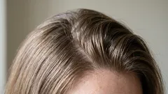 Vlasy se rychle mastí: proč k tomu dochází a co s tím?