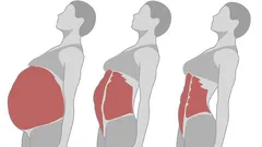 Pevné břicho a štíhlý pas: 4 cviky, které stojí za vyzkoušení